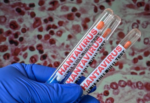 hantavirus y derecno marítimo